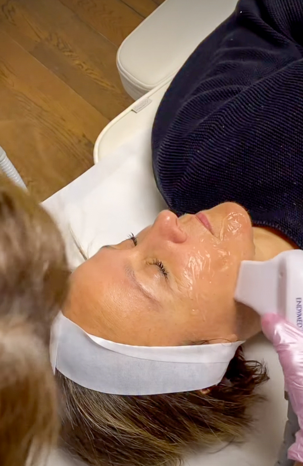 Radiofrequency facial, IG @sadaf_jaffari | Treatwell