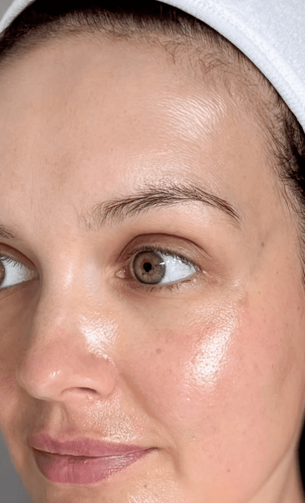 Vitaminc C-peeling, IG @skincarebyjoanne | Treatwell