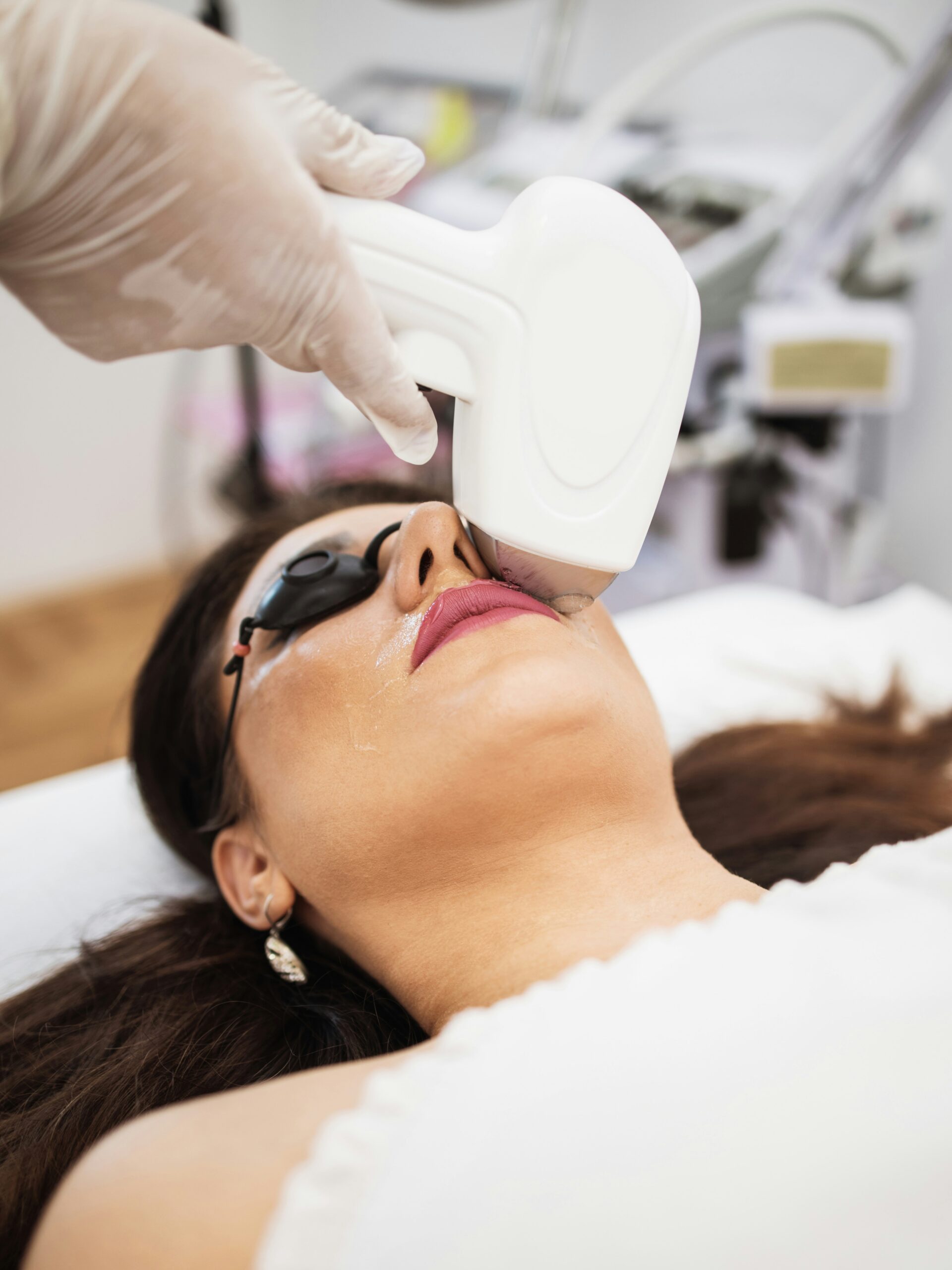 Vrouw krijgt een IPL-behandeling op de bovenlip in een kliniek