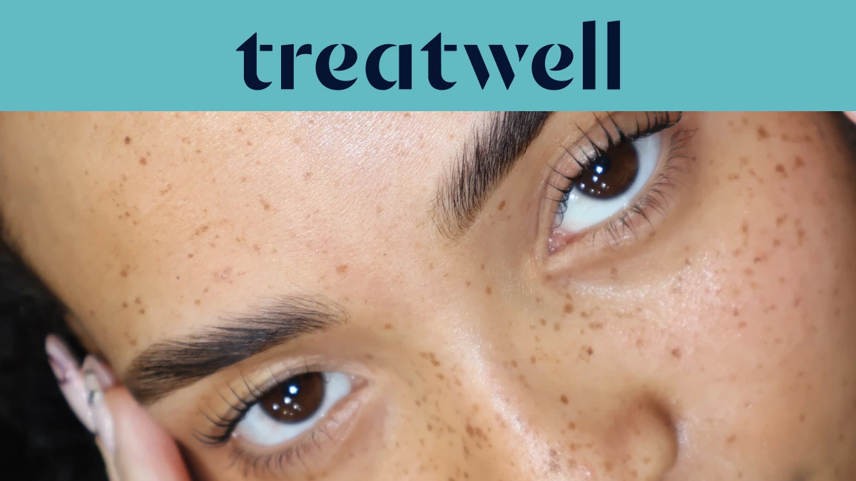 Turquoise Treatwell-banner met een close-up van natuurlijk gelifte wimpers na een Korean lash lift, op een huid met sproeten
