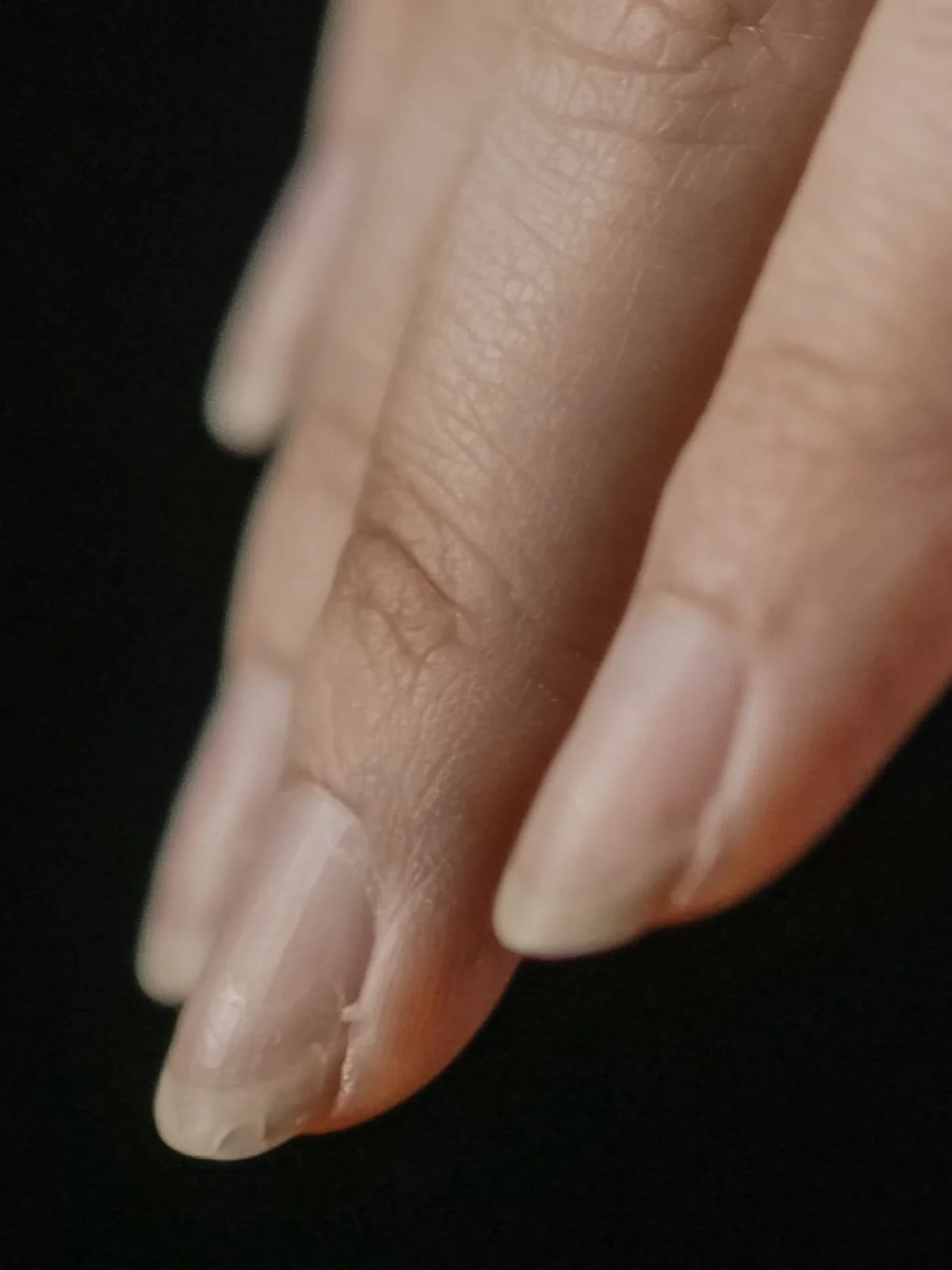 Close-up van enkele vingernagels met afbladdering aan de vrije rand